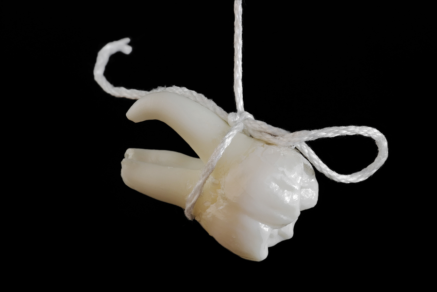 Post-Operative Care for Extractions : Dos and Don’ts