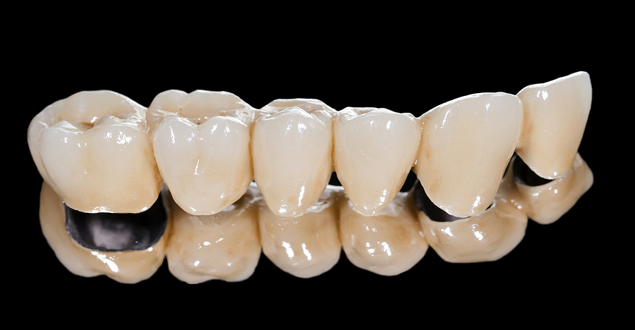 Restoring Your Smile with Dental Bridges in George, UT