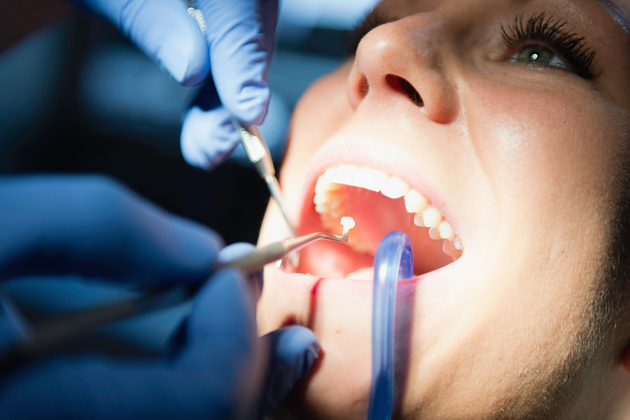 Restore Your Smile with Durable Fillings in George, UT