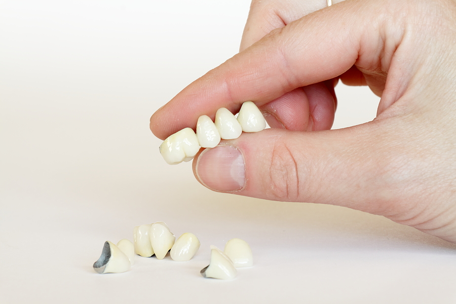 Enhance Your Smile with Porcelain Crowns in George, UT
